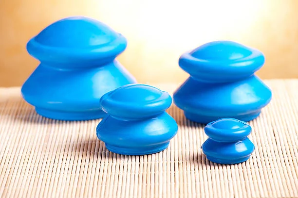 Blue silicone cupping cups arranged on a white surface